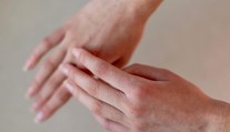 Zima poškodzuje pokožku viac, než si myslíte. Dermatologička radí, čo pomáha