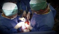 Vo Viedni vykonali prvú transplantáciu pľúc pacientovi s koronavírusom