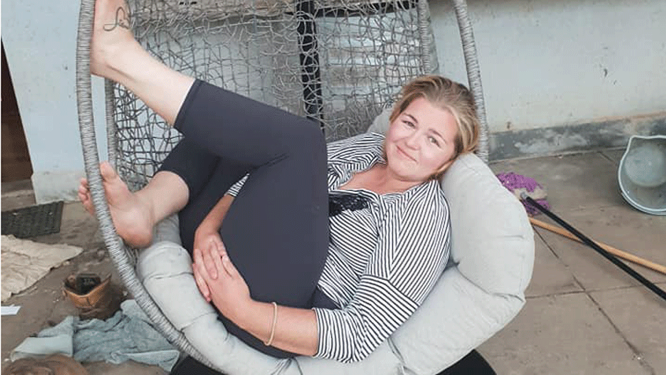 Obrovské nešťastie. Žena spadla tvárou do ohniska, utrpela vážne popáleniny