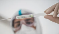 Blížime sa k stropu: Kapacity PCR testov môžeme naplniť už o pár dní