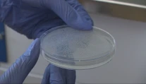 Hygienici stále testujú vzorky z kúpaliska v Štúrove. Boli sme sa pozrieť, ako skúmajú améby priamo v laboratóriách