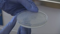 Hygienici stále testujú vzorky z kúpaliska v Štúrove. Boli sme sa pozrieť, ako skúmajú améby priamo v laboratóriách