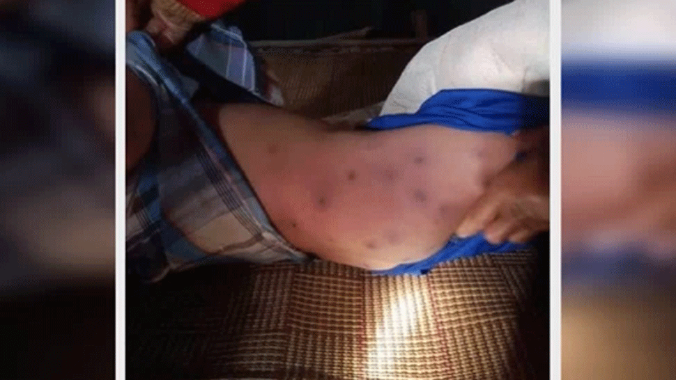 Päťročný chlapec zomrel po útoku 30 ôs. Jeho stará mama bojuje o život