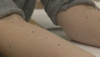 Vedeli ste, že na testy na alergiu nemusíte čakať do zimy?