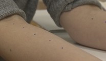 Vedeli ste, že na testy na alergiu nemusíte čakať do zimy?