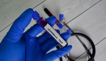 V Rakúsku sa šíri nebezpečné ochorenie. Zabilo už troch ľudí, nakazených pribúda