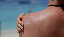 Mnohí sa natierajú opaľovacím krémom zle. Dermatologička varuje pred častou chybou
