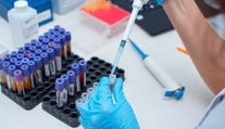 Prelomový liek na HIV je objavom minulého roka. Vírus však stále nedokáže vyliečiť