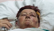 Helena prežila nehodu autobusu, no zostáva v srbskej nemocnici