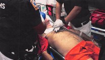 Epsteinova smrť vyvoláva znepokojujúce otázky. Bolo to skôr uškrtenie ako vražda, tvrdí patológ, ktorý bol pri pitve