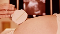 Starostlivosť o tehotné ženy je u nás špičková, hovorí odborník. Garancia dokonalého pôrodu však nie je a nikdy nebude