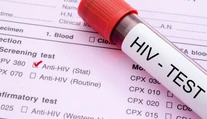 Epidémia AIDS je s nami už 35 rokov, ako prví jej podľahli homosexuáli