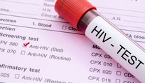 Epidémia AIDS je s nami už 35 rokov, ako prví jej podľahli homosexuáli