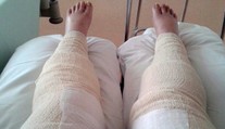 Šokujúci prípad. Oholila sa v oblasti bikín a takmer prišla o nohy