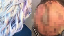 Mamička vyskúšala populárnu farbu na vlasy. Výsledkom bola oskalpovaná hlava