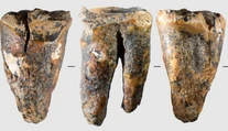 Vedci zostali po objave v šoku. Neandertálec si mal pred 59-tisíc rokmi „vyvŕtať“ pokazený zub