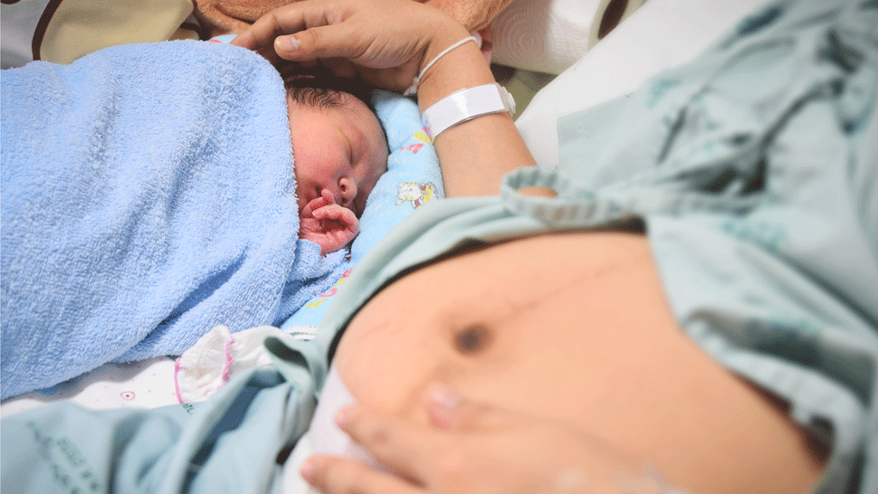 Deti narodené cisárskym rezom majú väčšiu šancu, že budú obézne a budú mať diabetes