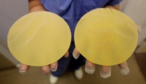 Súd rozhodol v kauze nekvalitných prsných implantátov, desiatky tisíc žien sa dočkajú odškodného