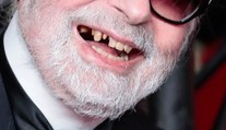 Hviezda šokovala fanúšikov. Otvoril ústa a zuby nikde