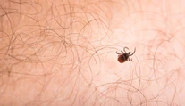 Po uhryznutí kliešťom dostal alergiu na mäso. Tínedžera zabila hovädzia klobása