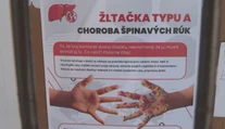 Žltačka útočí na juhu Slovenska. Šíri sa mestom aj okolitými obcami, evidujú už vyše 120 prípadov