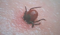 Viete si správne vybrať kliešťa? Na olej a točenie v protismere hodinových ručičiek zabudnite