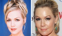 Aj ona podľahla plastike. Kelly z Beverly Hills natiahnutá a pribratá