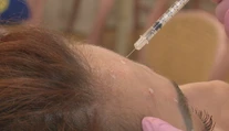 Botox a výplne mali dostať prísnejšie pravidlá. Zo zákona napokon vypadla dôležitá časť