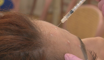 Botox a výplne mali dostať prísnejšie pravidlá. Zo zákona napokon vypadla dôležitá časť