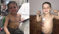 Smrteľne chorý chlapec sa neprestáva usmievať. Jeho fotka inšpirovala svet