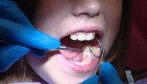 Zubárka uviedla tri potraviny, ktoré spôsobujú problémy s ďasnami. O jednej ste možno ani netušili