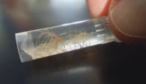 Nenápadný zabijak domácich miláčikov. Veterinári upozorňujú na pľúcne červy