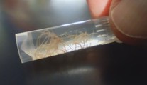 Nenápadný zabijak domácich miláčikov. Veterinári upozorňujú na pľúcne červy