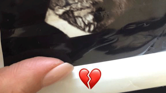 Srdcervúce priznanie slávnej herečky. Prišla o bábätko