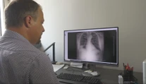 Šokujúci záver záhadného zápalu pľúc pri Handlovej. Vedci zistili pôvod baktérie, nestretli sa s ňou desiatky rokov