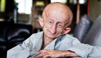 Stala sa hlasom ľudí so vzácnou genetickou poruchou. Hviezda TikToku zomrela vo veku 19 rokov