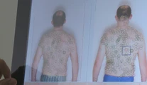 Pozor na UV žiarenie spôsobujúce rakovinu. Na Slovensku najviac ohrozuje tieto skupiny ľudí
