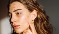 Šíri sa návod, ako sa zázračne zbavíte akné. Dermatologička vysvetľuje, prečo je to hrozný nápad