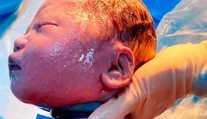 Lekári neverili vlastným očiam. Bábätko malo okolo krku šesťkrát omotanú pupočnú šnúru