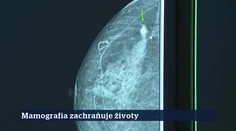 8. epizóda | 22. 9. 2026 | Miroslav Tomáš