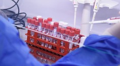 Koronavírus v piatok potvrdili 40 ľuďom, máme ďalšie úmrtia