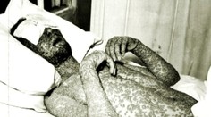 Kiahne ako biologická zbraň? Vedci majú jasno