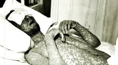 Kiahne ako biologická zbraň? Vedci majú jasno