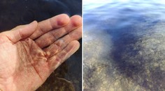 Vyšli ste z vody bodkovaní? Čierne zrnká zaplavili bratislavské jazerá