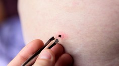 Robíte to takto? Odborníčka vysvetlila, ako správne vyberať kliešte