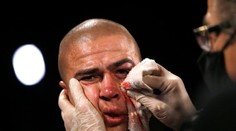 VIDEO: Krvavý zápas, no na vyhlasovaní bojovník ako zo škatuľky. Ako to cutmani robia?