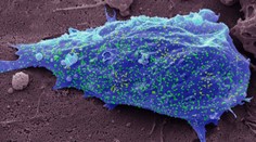 V ČR je nový subvariant omikronu; prekonanie nákazy proti nemu nepomáha