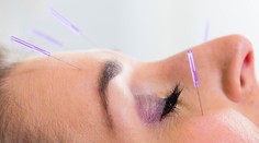 Ste chorí? Akupunktúra pozná liek na všetko