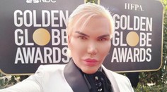 Vrchol nechutnosti: Ľudskému Kenovi (34) odstránili štyri rebrá, odfotil si ich a ukázal