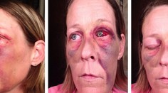 Takto má vyzerať láska? Selfie dobitej ženy má jasný odkaz